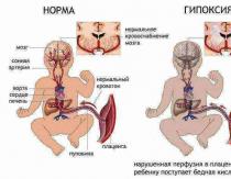 Гипоксия у ребенка 2 года симптомы и лечение