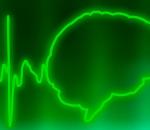 Смерть головного мозга: причины, признаки, постановка диагноза Сколько может прожить мозг после остановки сердца